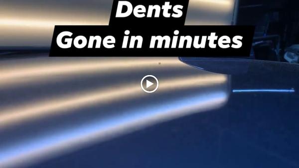Hail To the Dent