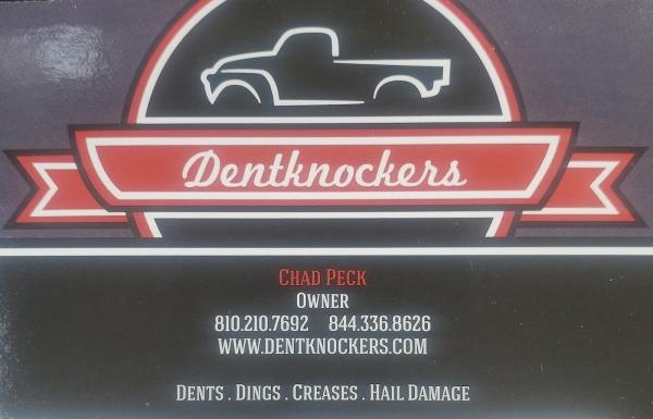 Dentknockers